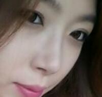 武漢藝齡整形醫(yī)院做駝峰鼻矯正價(jià)格12k，真實(shí)案例恢復(fù)過程圖