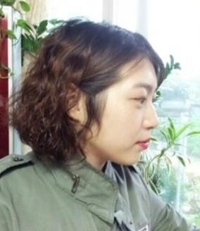 武漢藝齡整形醫(yī)院做駝峰鼻矯正價格12k，真實案例恢復(fù)過程圖