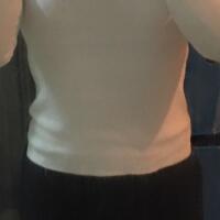 抽脂減肥瘦腰腹手術(shù)價格1.3w真實(shí)案例前后對比圖 武漢藝齡整形