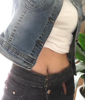 腹部吸脂兩個(gè)月親身經(jīng)歷 深圳仁安雅吸脂案例