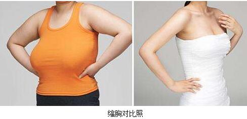 巨乳如何縮??？巨大乳房縮小需要注意什么？