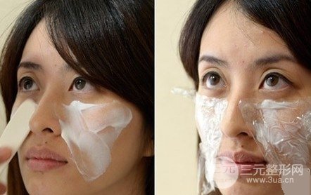 “人未老，皺先行”，注射除皺面部年輕化修復(fù)過程