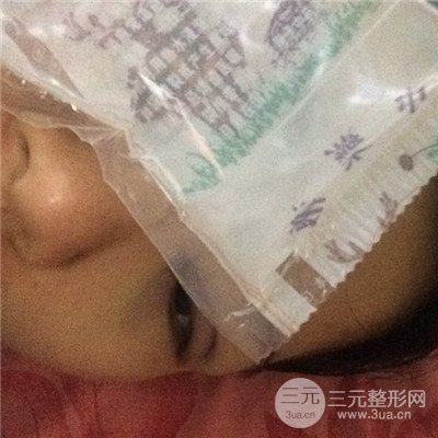 濟南曹博士美容醫(yī)院曹景敏眼部綜合整形真人案例分享