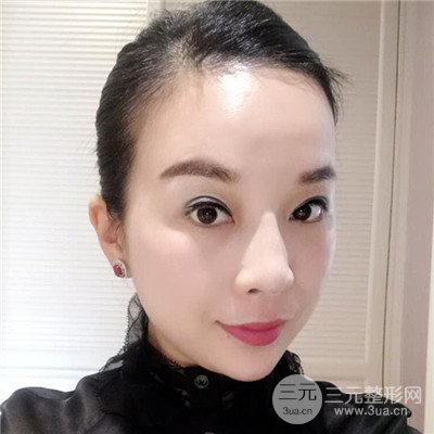 濟南曹博士美容醫(yī)院曹景敏埋埋蛋白線.提升真人案例分享