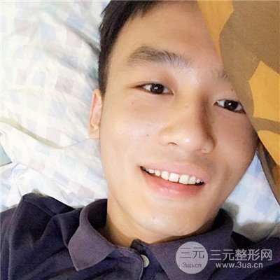 濟南曹博士魯開化祛痘坑痘印真人案例分享