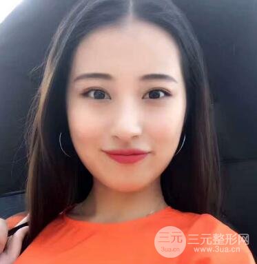 痘坑痘疤要怎么修復(fù)?果酸換膚后臉果圖和真實(shí)案例分享