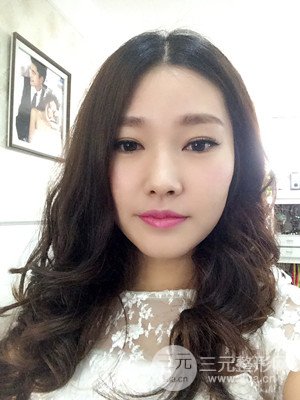 南昌永康整形打水光補(bǔ)水果圖前后對(duì)比