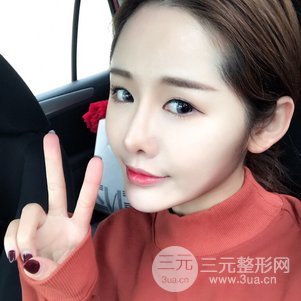 南京美萊陳天杰自體脂肪填充全臉 女神的養(yǎng)成記！
