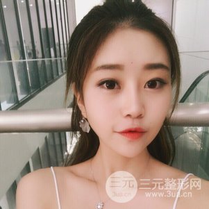 上海九院鼻部韓式生科芭比線條修復(fù)