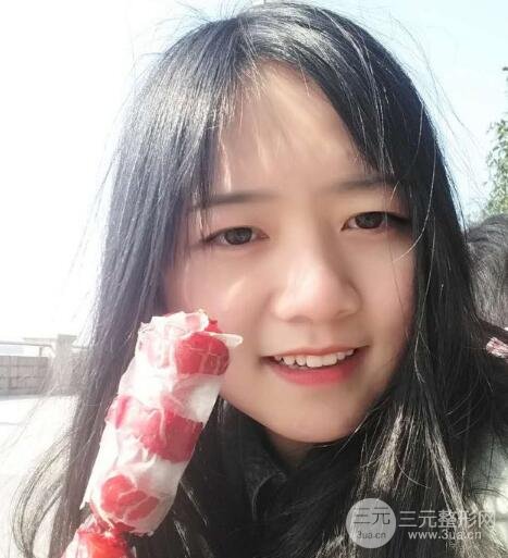 怎樣減掉雙下巴？雙下巴吸脂后個人經(jīng)歷 價格略貴但果好