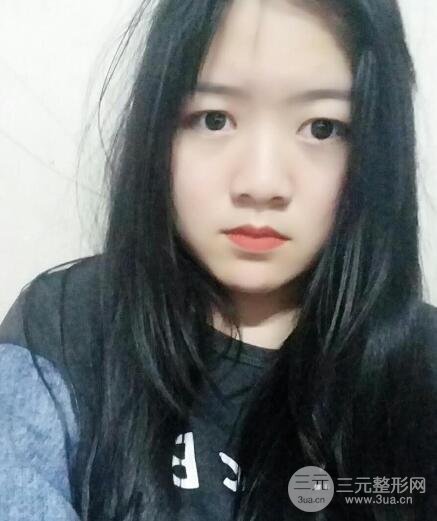 怎樣減掉雙下巴？雙下巴吸脂后個人經(jīng)歷 價格略貴但果好