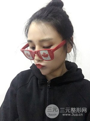 珠海萊茵門診部馬中衛(wèi)隆鼻整形案例分享，并附上前后對(duì)比照片~