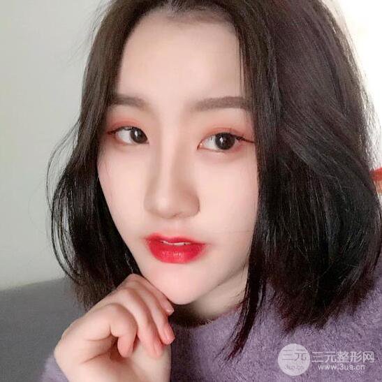 膨體隆鼻三十天恢復(fù)記錄，術(shù)前術(shù)后對比圖片曝光