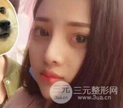 上海鼻子整形專家、價(jià)格和案例