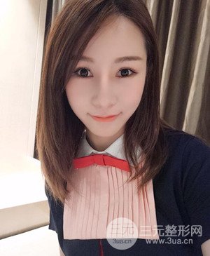 武漢美都張召醫(yī)生給我做的隆鼻整形手術(shù)，給大家分享一下前后照片