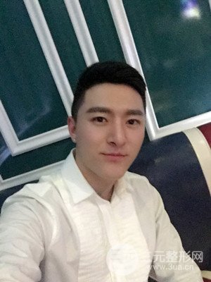 玻尿酸豐額頭手術(shù)前后過程以及真實(shí)案例分享——武漢美都朱紅霞醫(yī)生做的