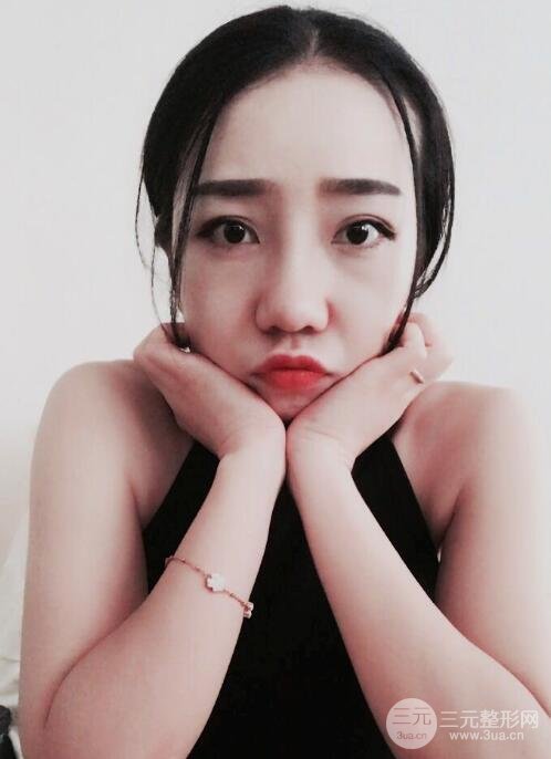 隆鼻整形價(jià)格和真人案例