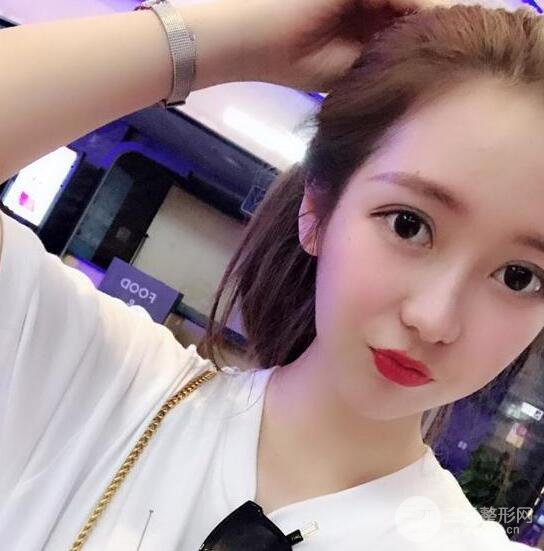 長得太著急是怎樣一種體驗？妹子血淚分享自體脂肪填充詳細部年輕化經(jīng)驗