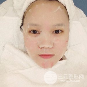 注射水光補(bǔ)水案例——襄陽維多利亞聶立敏醫(yī)生做的