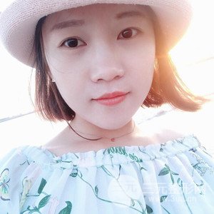 注射水光補(bǔ)水案例——襄陽維多利亞聶立敏醫(yī)生做的