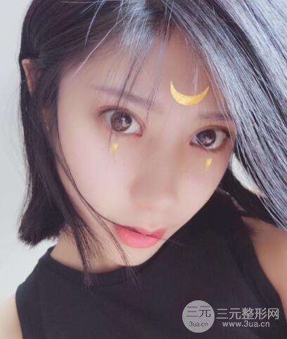 成都嬌點李競割雙眼皮價格和案例