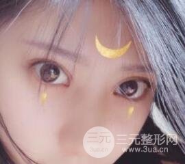 成都嬌點(diǎn)李競(jìng)割雙眼皮價(jià)格和案例