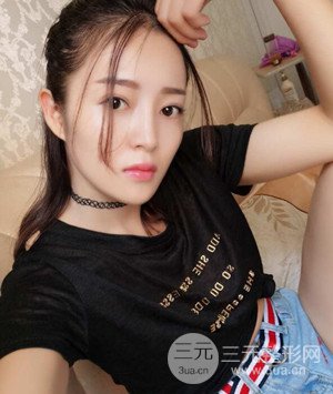 武漢葉子葉飛醫(yī)生給我做的切開雙眼皮手術(shù)，分享一下前后對比圖