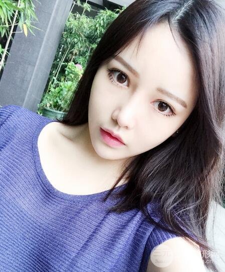 成都嬌點(diǎn)整容醫(yī)院李競(jìng)做全臉脂肪填充案例