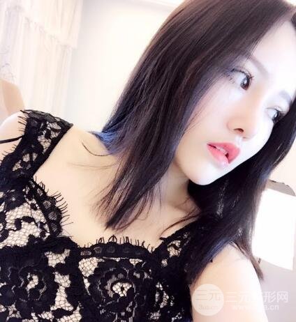 成都嬌點(diǎn)整容醫(yī)院李競(jìng)做全臉脂肪填充案例