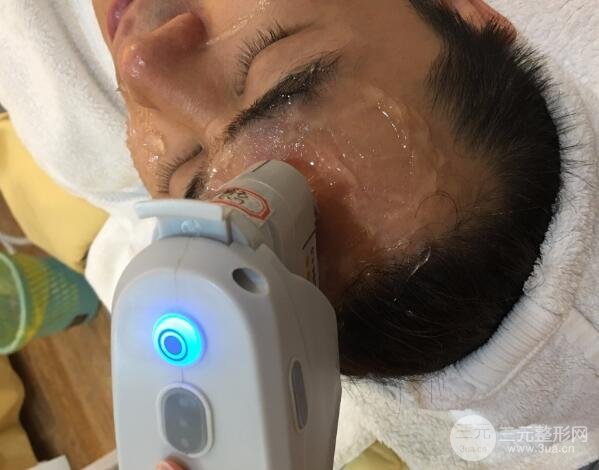 男士高強(qiáng)度聚焦超聲面b提升微整形真實(shí)案例