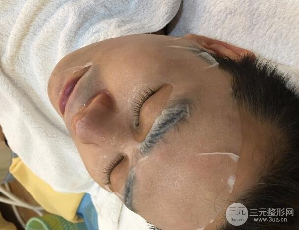 男士高強(qiáng)度聚焦超聲面b提升微整形真實(shí)案例