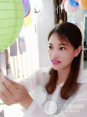 激光祛斑真實案例——武漢一美王朝輝醫(yī)生做的