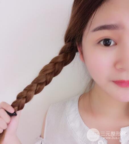 全切開(kāi)雙眼皮價(jià)格和恢復(fù)過(guò)程對(duì)比圖片