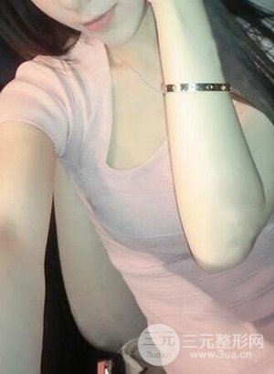 武漢繹君毛林醫(yī)生給我做的假體隆胸手術(shù)，分享一下前后對(duì)比圖