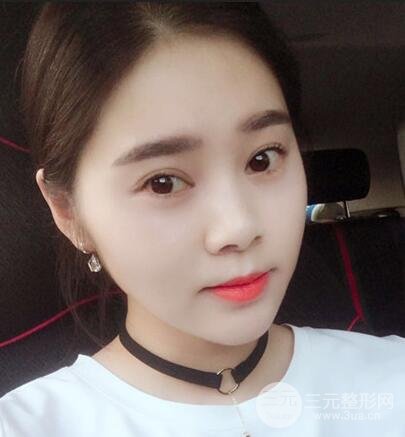 晉城鳳凰整形美容醫(yī)院微針?biāo)夤窒? /> </a>
									</div>
								</dd>
							</dl>
						</div>
					</div>
				</div>

				<div   id=