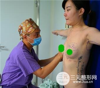 北京偉力嘉美信馬永奇自體脂肪隆胸案例圖片