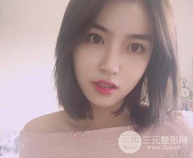 南京康美陳小劍做的雙眼皮案例果真實的分享給你們！