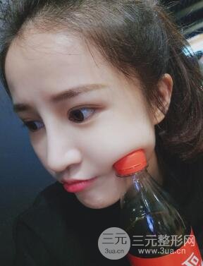 柏麗李勁良假體隆鼻案例果分享！小巧精致又立體~