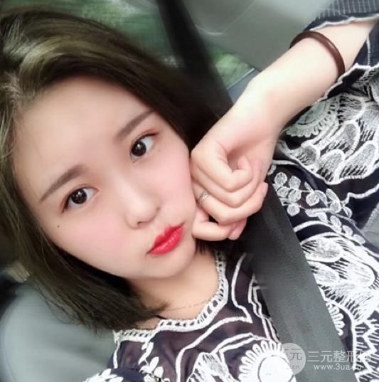 面部光纖溶脂三個月恢復記錄，妹子終于擺脫大臉盤子辣