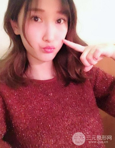 蘇州美貝爾假體隆胸案例，對比圖恢復過程分享~