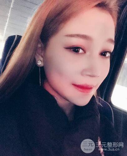 【下頜角+顴骨+下巴】全臉磨骨整形，術(shù)后的我人生開掛了！