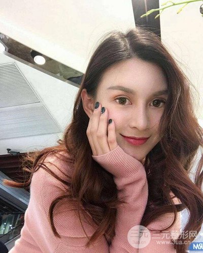 南京華美沈正宇假體隆鼻恢復過程前后對比圖分享~