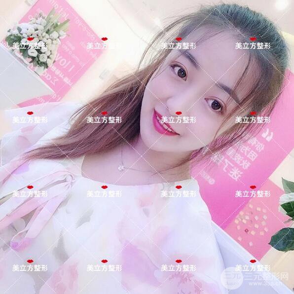 西安美立方雙眼皮怎么樣？真實(shí)案例圖片反饋~