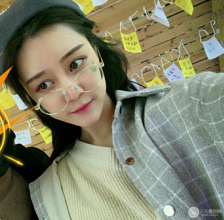 上海百*麗顧清自體脂肪填充恢復過程前后對比圖分享~