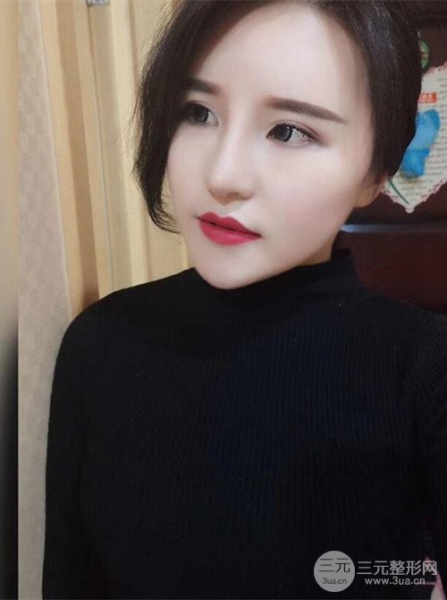 上海麗質(zhì)呂成醫(yī)生做的吸脂瘦臉日記，前后恢復(fù)圖分享