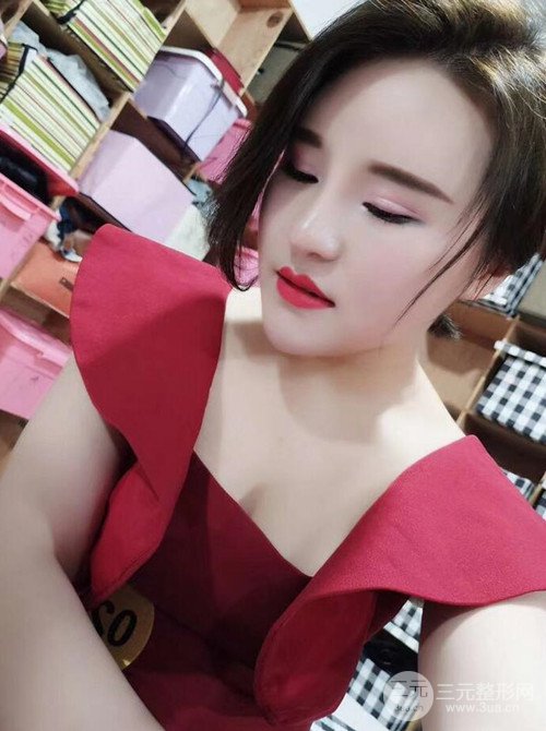 上海麗質(zhì)呂成醫(yī)生做的吸脂瘦臉日記，前后恢復(fù)圖分享