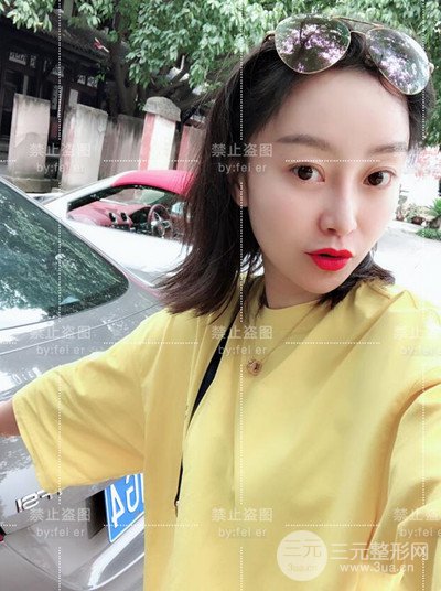 成都恒博發(fā)際線種植恢復過程分享