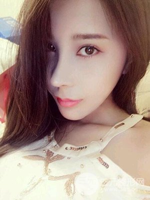 成都美萊牛永敢自體肋軟骨隆鼻案例，前后對比圖分享~