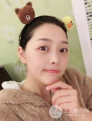 面部吸脂瘦臉手術(shù)日記分享，瘦臉果驚人