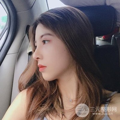 廣州藝美隆鼻日記分享！前后對(duì)比圖奉上！